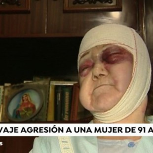 Brutal agresión a una mujer de 91 años en Barcelona