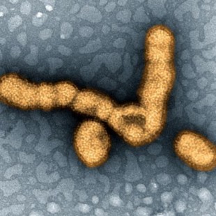 Cómo las bayas de saúco actúan sobre el virus de la gripe