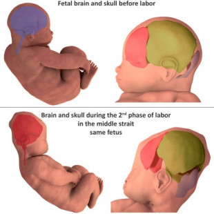 Así se deforma la cabeza de los bebés para facilitar el parto