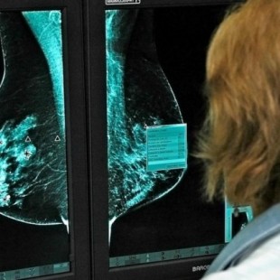 Llega a España un fármaco que mejora el cáncer de mama metastásico