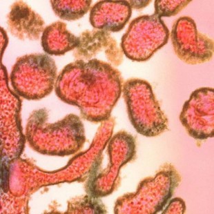 El sarampión borra la memoria del sistema inmunitario [ENG]