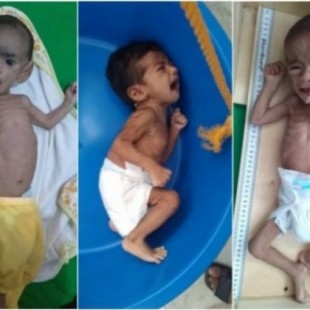 Retablo de los niños esqueléticos en Yemen