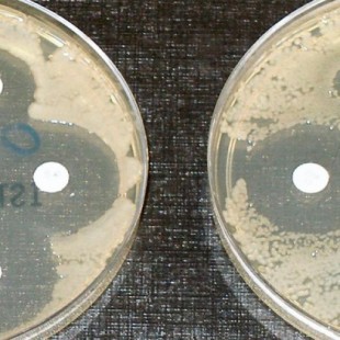 Descubren dos nuevos antibióticos que no generan resistencia