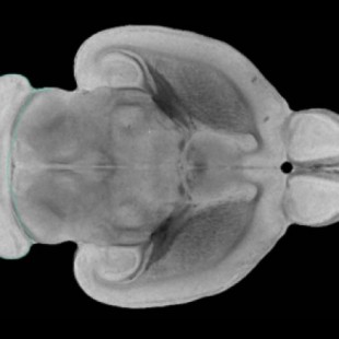 Científicos revierten el proceso de envejecimiento en células madre cerebrales de ratas [EN]