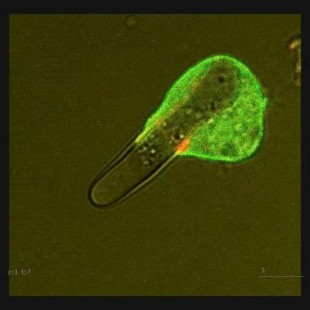 Ameba intentando ingerir una célula de levadura