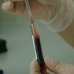 Investigadores japoneses crean sangre artificial que sirve para cualquier grupo sanguíneo