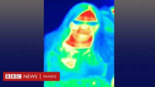 Una cámara térmica de un museo descubrió que una mujer padecia cáncer