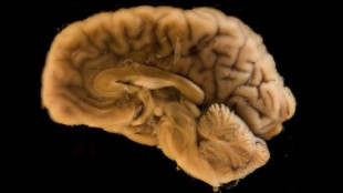 Los mini cerebros creados en laboratorio con neuronas humanas desatan un debate ético