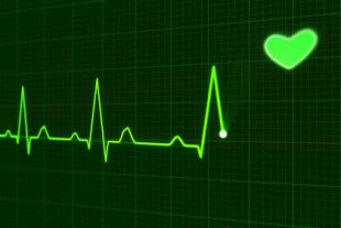 IA predice la probabilidad de morir en el siguiente año a partir de un electrocardiograma