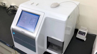 Toshiba anuncia un dispositivo capaz de detectar 13 tipos de cáncer con una precisión del 99% de una sola gota de sangre
