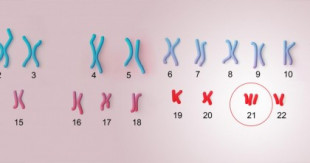 Revierten en ratones los déficits de memoria y aprendizaje característicos del síndrome de Down