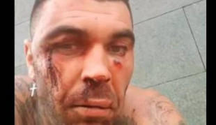 El ultra que agredió a un hombre en Bilbao, recibe una paliza en Tenerife