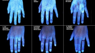 Las bacterias que se adhieren a tus manos después de diferentes métodos de lavado, en una sola imagen