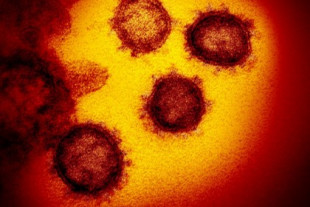 Las patentes ralentizan la vacuna del coronavirus