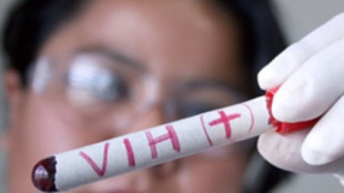 Confirmada la cura del VIH en un paciente tras más de dos años sin medicación ni rebote viral