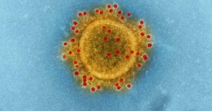 El coronavirus evolucionará hacia una forma menos agresiva