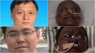 Desvelado el misterio de los médicos chinos que tienen la piel negra tras recuperarse de COVID-19