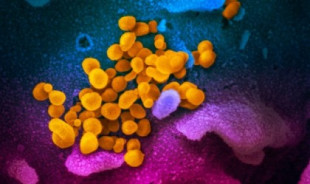 Coronavirus: un estudio estima 1,2 millones de españoles infectados