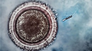 Un nanorobot empuja a un espermatozoide «vago» hacia el óvulo