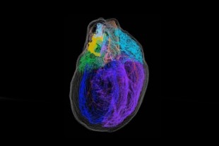 Este detallado mapa en 3D es el primero que muestra todas las neuronas de un corazón