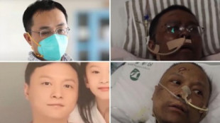 Muere uno de los dos médicos chinos cuya piel se volvió negra tras contraer coronavirus