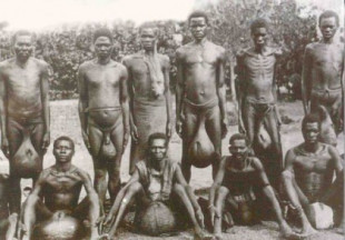 La tribu africana de los testículos gigantes