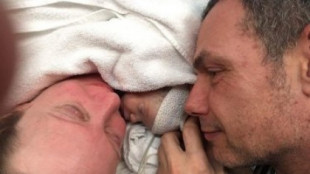 Una bebé 'milagro' muere después de un 'parto Lotus' en el hospital de Melbourne (en)