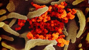 Los CDC eliminan referencias a transmisión aérea del coronavirus que habían publicado...