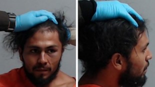 Denuncian a la Policía por romper el cuello a un detenido: le tuvieron que sujetar la cabeza para la foto