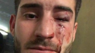 Fiscalía pide cinco años de cárcel por una brutal agresión homófoba contra un joven en el metro de Barcelona