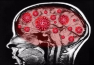 Todo sobre las secuelas neurológicas de la Covid-19 y el posible desarrollo de Alzheimer
