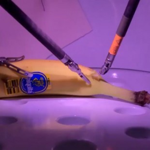 Un cirujano opera desde Londres un plátano que estaba en California gracias a la tecnología 5G