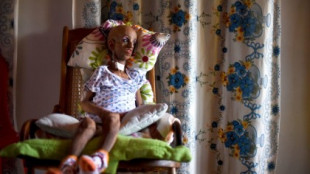 La terapia con CRISPR cura la progeria en ratones [EN]