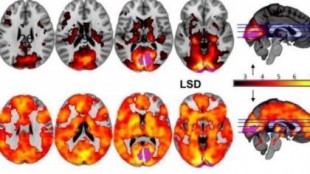 El LSD provoca que el cerebro funcione más allá de lo que dicta su propia anatomía, según un nuevo estudio