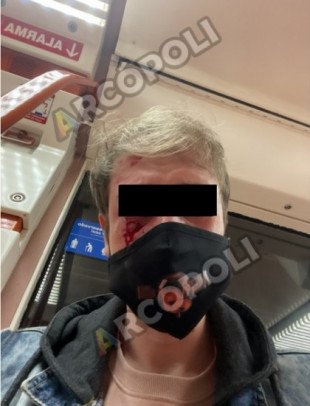 Un joven denuncia una agresión homófoba en el Metro de Madrid