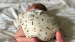 Un bebé nace con tres penes y los médicos creen que es el primer caso de trifalia en el mundo