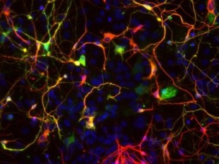 Transforman por primera vez astrocitos en neuronas para reparar circuitos visuales