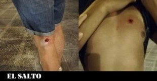 Abuso policial en Granada: revientan un móvil contra el suelo y disparan a un joven con material antidisturbios