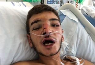 Así ha quedado el rostro del joven de 17 años tras ser agredido en La Ribera (Ceuta)
