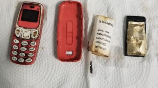 Va al hospital por fuertes dolores de estómago y descubre que se ha tragado un Nokia 3310
