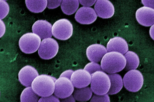 Por fin sabemos cómo la penicilina destroza la pared celular de una bacteria superresistente y esto es una noticia sensacional