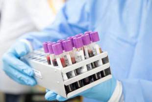 Nuevo test permite detectar más de 50 tipos de cáncer con una sola muestra de sangre