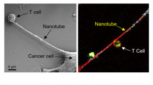 Las células del cáncer usan ‘tentáculos’ diminutos para inhibir el sistema inmunitario