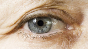 Un investigador español descubre las causas de la ceguera asociada a la edad: un paso clave para prevenirla