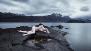 Vello púbico y nudismo: la batalla de la fotografía por representar el cuerpo desnudo [NSFW]