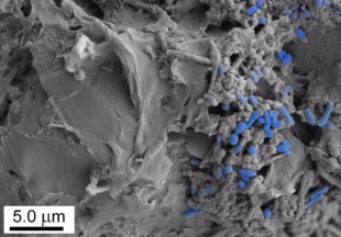 Investigadores del CSIC descubren que la ingesta de microplásticos altera la microbiota intestinal