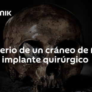 El misterio de un cráneo de Perú con un implante quirúrgico