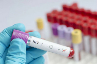 Científicos en EE.UU. logran curar a una mujer del VIH
