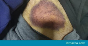 Tres jóvenes acusan a policías locales de Granada de torturas y detención ilegal