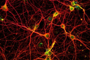 Descubren neuronas ‘cantarinas’ que solo se activan en nuestro cerebro con el canto